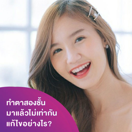 ทำตาสองชั้นมาแล้วไม่เท่ากัน แก้ไขอย่างไร รวมทุกสาเหตุและวิธีแก้