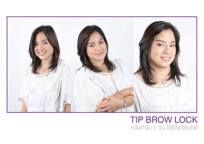 ยกคิ้ว ธีรพรคลินิก